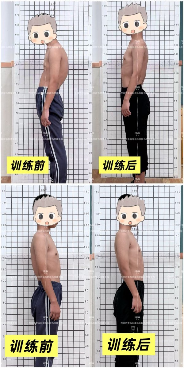 配资台 【杏林医讯】含胸驼背到挺胸抬头，这夏令营咋做到的？